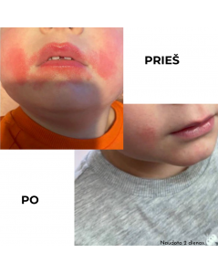 KOKOSO BABY apsauginis pieštukas su kokosų aliejumi visai šeimai, Levandų kvapo